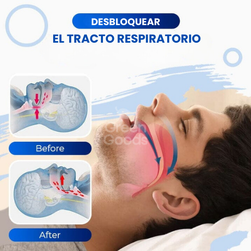 SPRAY ANTI RONQUIDOS-¡DUERME TRANQUILO! 😴