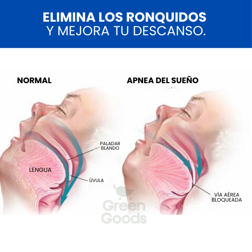 SPRAY ANTI RONQUIDOS-¡DUERME TRANQUILO! 😴