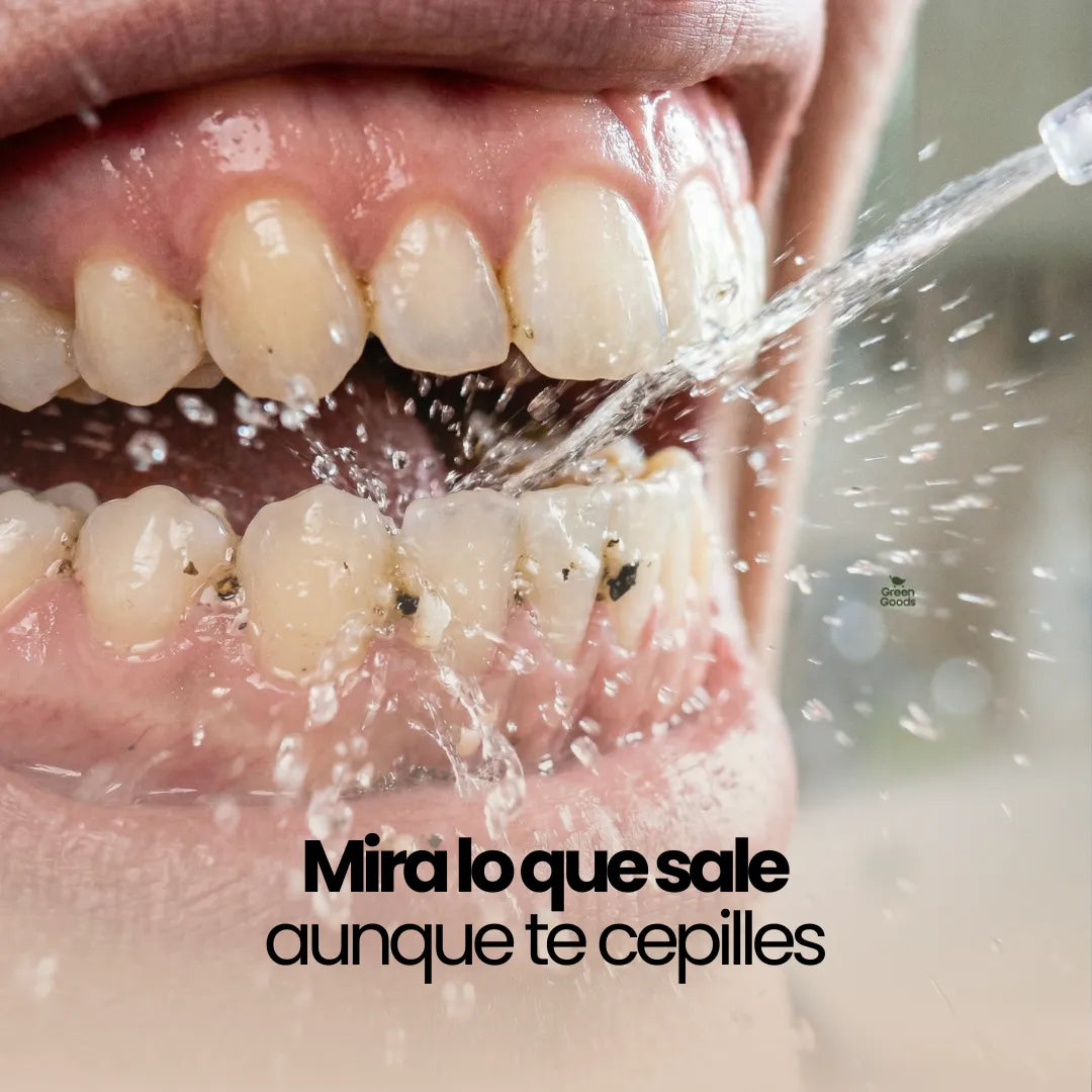 Tus dientes más blancos - Irrigador Eléctrico Bucal