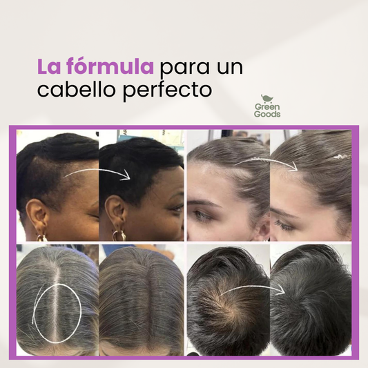FIBRA CAPILAR CORRECTORA-MÁS VOLUMEN Y DENSIDAD EN TU CABELLO 🔝