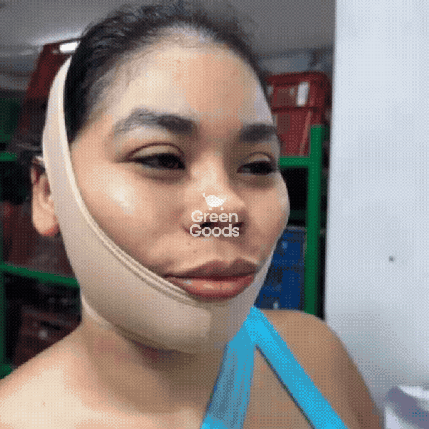 Corrector de Papada - Un rostro más firme y definido