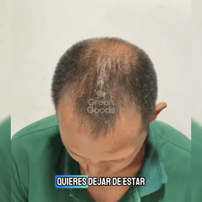 Tónico Ancestral Anticaída Hombres y Mujeres-¡Ampolleta Crecimiento de Regalo! 🎁
