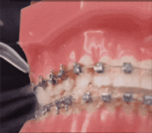 Tus dientes más blancos - Irrigador Eléctrico Bucal