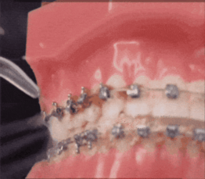 Tus dientes más blancos - Irrigador Eléctrico Bucal